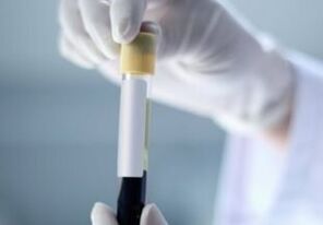 Análise de sangue para detectar parasitos no corpo